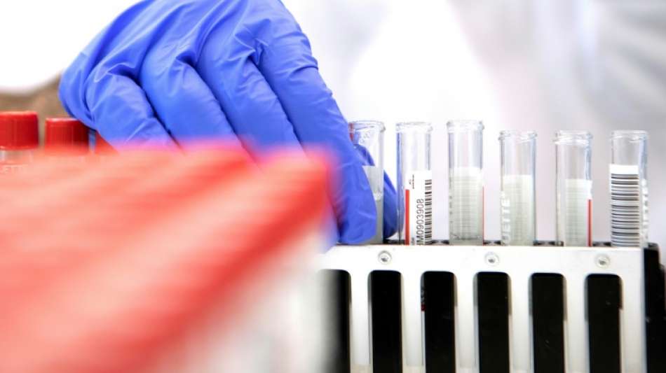 Fast 600 Millionen Euro f&uuml;r au&szlig;eruniversit&auml;re Coronaforschung in 2020