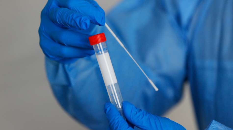ARD-Recherche: Dopingexperimente an DDR-Freizeitsportlern