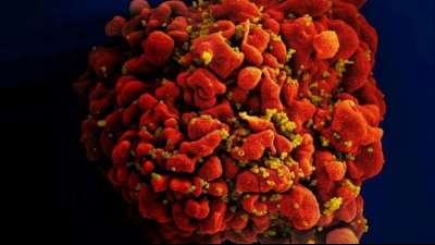 R&uuml;ckschlag bei Suche nach Impfstoff gegen HIV/Aids