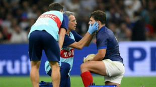 France captain Dupont has surgery on fractured cheekbone