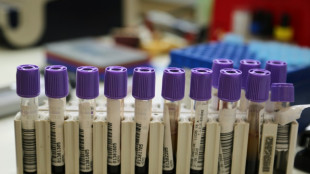 Ocho niños muertos por un brote de leptospirosis en una comunidad indígena de Ecuador