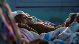 Una persona muere de hambre en el mundo cada cuatro segundos, denuncian oeneg&eacute;s