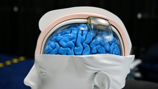 'We're already living in science fiction': The neurotech revolution