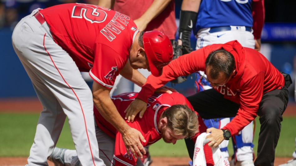 Angels' Ward has facial fractures after hit by pitch
