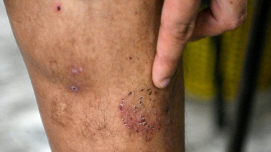 El "infierno" de los trabajadores v&iacute;ctimas de tr&aacute;fico en Camboya