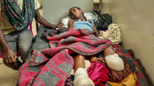 Guerre en Ethiopie: dans un h&ocirc;pital de Mekele, au Tigr&eacute;, des enfants amput&eacute;s, la douleur partout