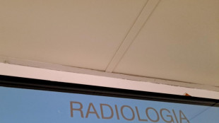 Da Tac a mammografi, pi&ugrave; di una su 3 ha oltre 10 anni
